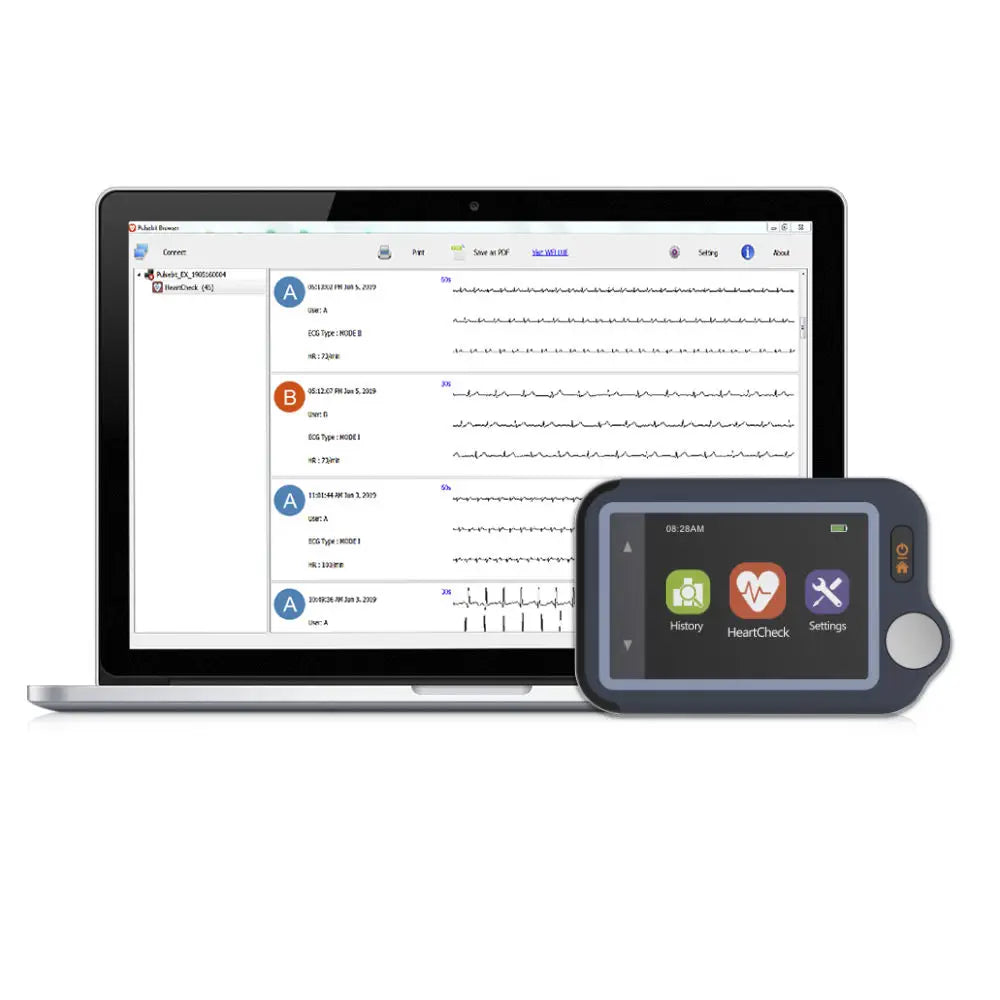 Moniteur ECG à écran tactile - Checkme Plus
