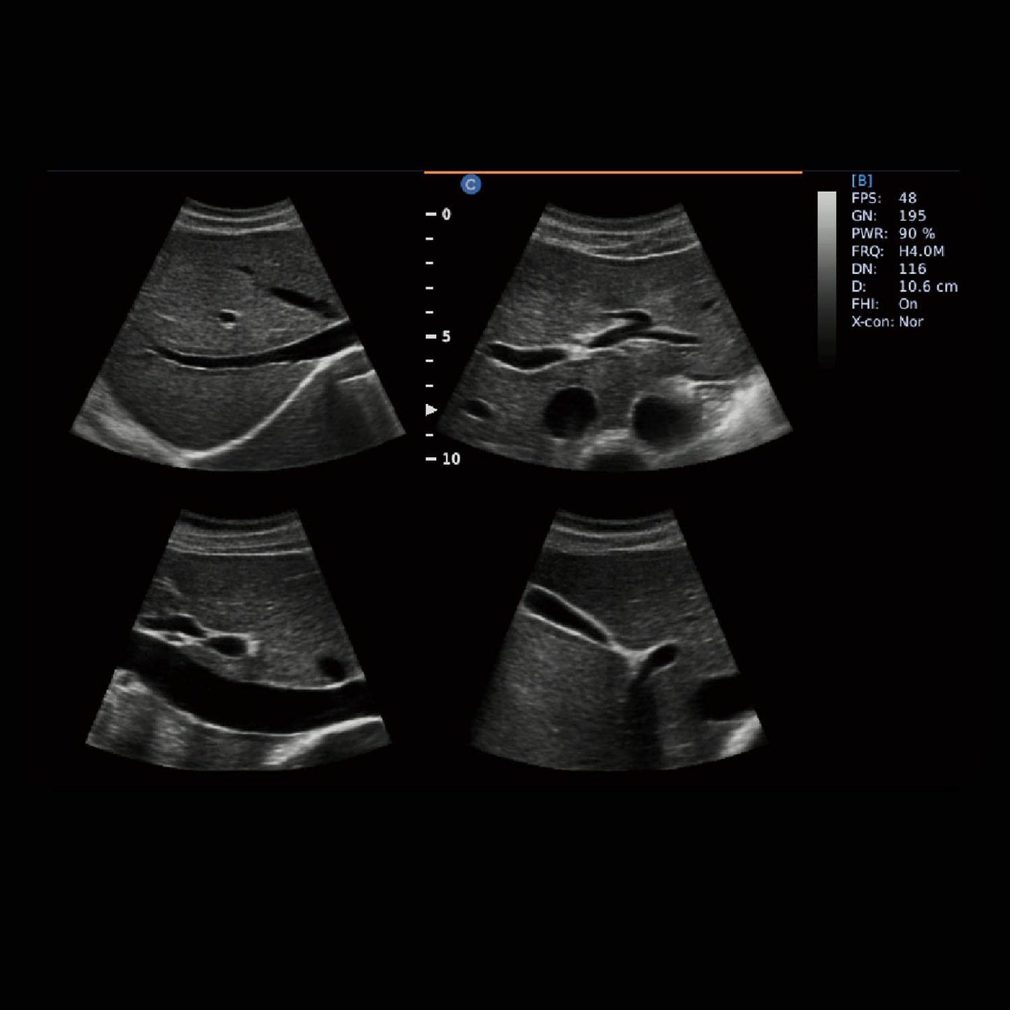 Chison - Échographe Portable Multifonction pour une Imagerie Médicale de Haute Précision EBit 30