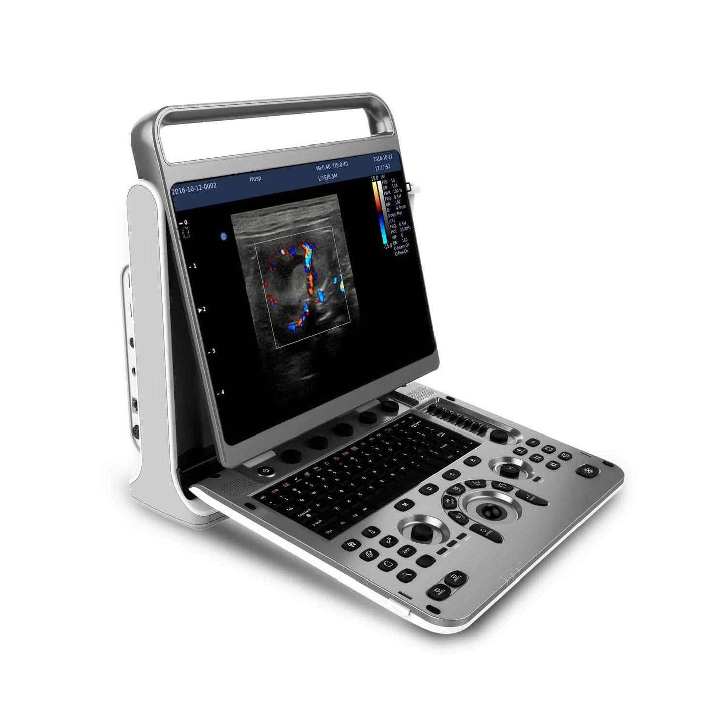 Chison - Échographe Portable Multifonction pour une Imagerie Médicale de Haute Précision EBit 30