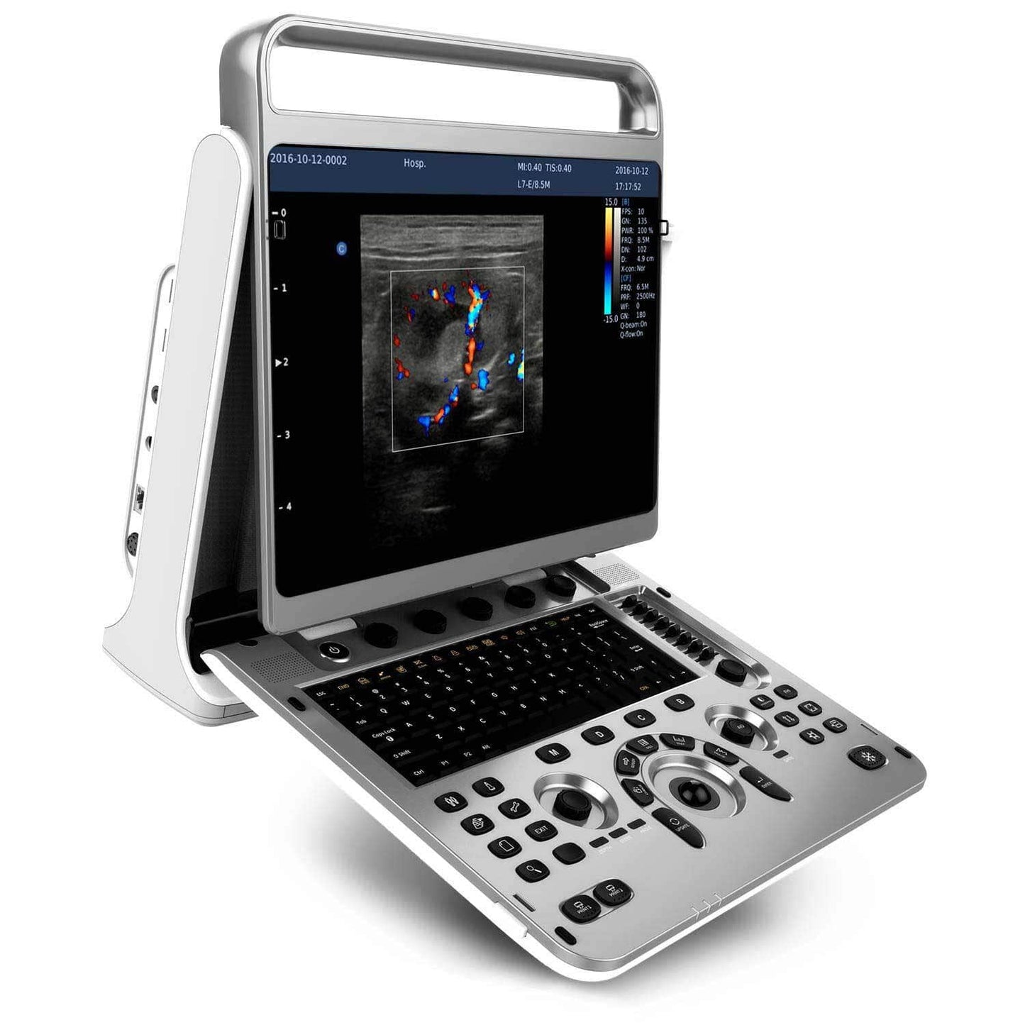Chison - Échographe Portable Multifonction pour une Imagerie Médicale de Haute Précision EBit 30