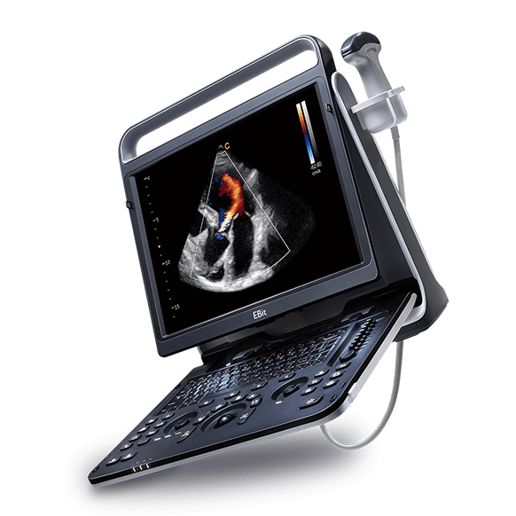 Chison - Échographe Doppler Couleur Portable - EBit 60