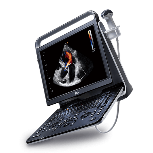 Chison - Échographe Doppler Couleur Portable - EBit 60