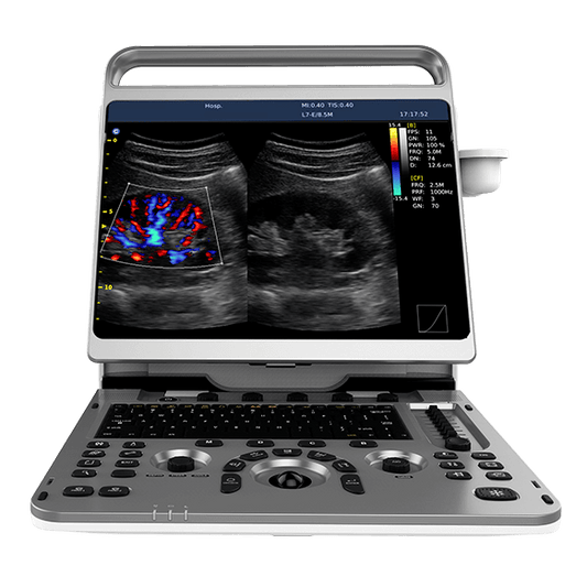 Chison - Échographe Portable Multifonction - EBit 50