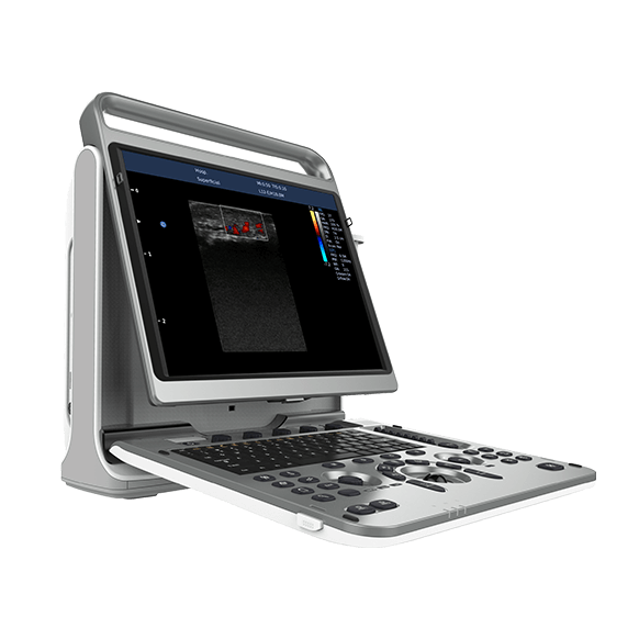 Chison - Échographe Portable Multifonction - EBit 50