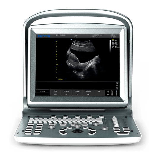 Chison - Echographe portable à ultrasons Portable ECO 5