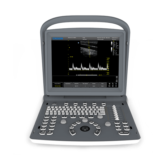 Chison - Echographe portable à ultrasons Portable ECO2