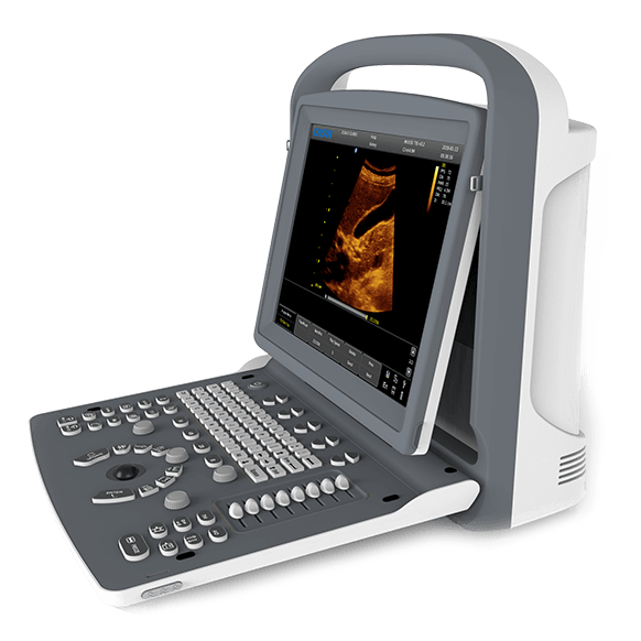 Chison - Echographe portable à ultrasons Portable ECO2