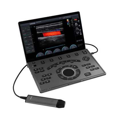 Échographe Portable CHISON SonoAir 30 avec 2 sondes et support mobile