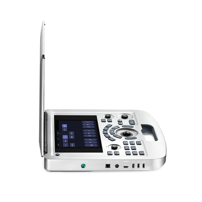 EDAN - Échographe Portable Acclarix AX3 – Système Ultrasons Compact Haute Performance