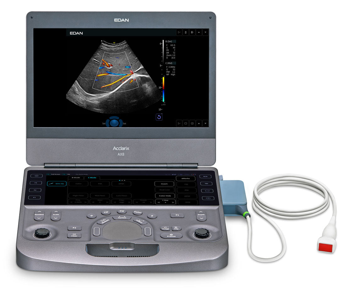 EDAN - Échographe Portable Acclarix AX8 – Système Ultrasons Compact Haute Performance