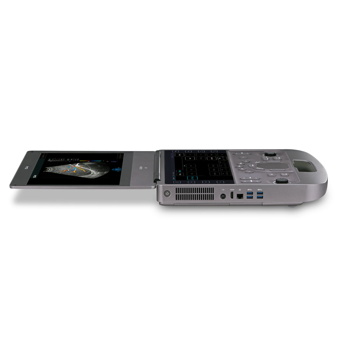 EDAN - Échographe Portable Acclarix AX8 – Système Ultrasons Compact Haute Performance